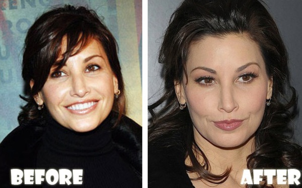 Gina Gershon plastic surgery